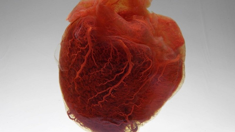 Почему мелкоочаговый кардиосклероз может стать причиной смерти?